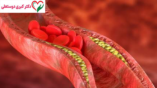Lp(a) بالا یعنی چه؟