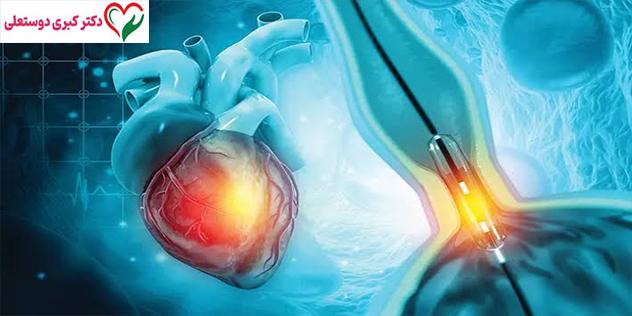 ورزش پس از آنژیوگرافی