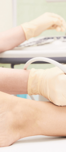 Sonography-leg-varicose-veins