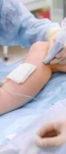 Treatment-of-varicose-veins-with-radiofrequency-or-intravascular-laser-300x200