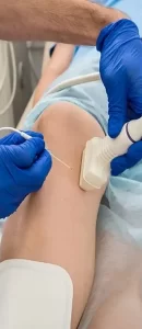 rf-واریس-اندام-تحتانب